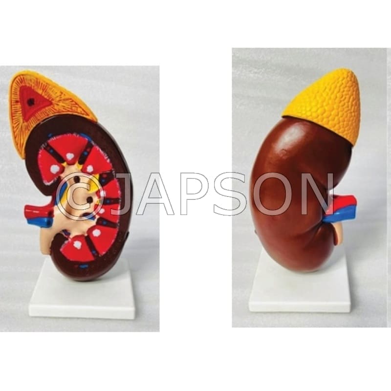 Kidney Model Large Model