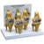 4 Stages Knee Arthritis Model