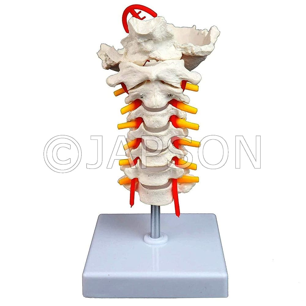 Cervical Spine with Neck Artery and Occipital Bone Model