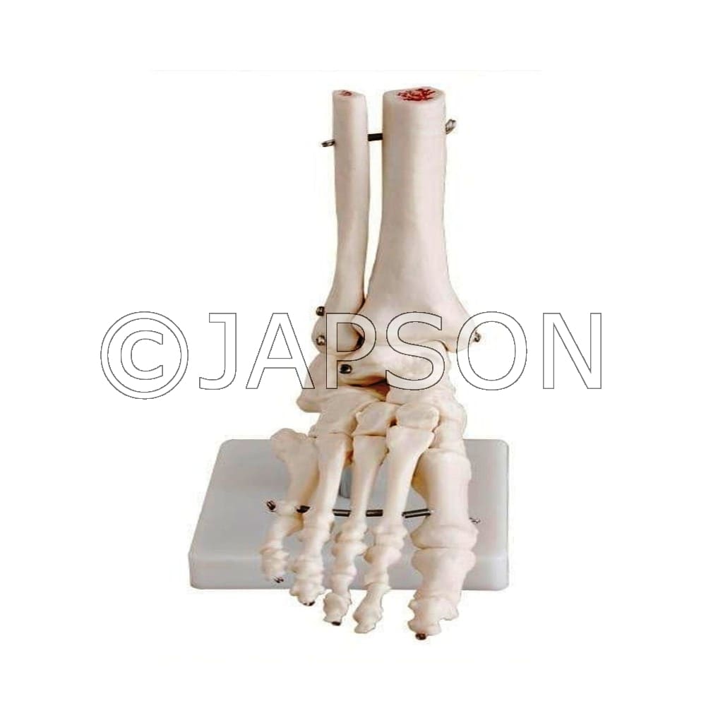 Foot Joint Model