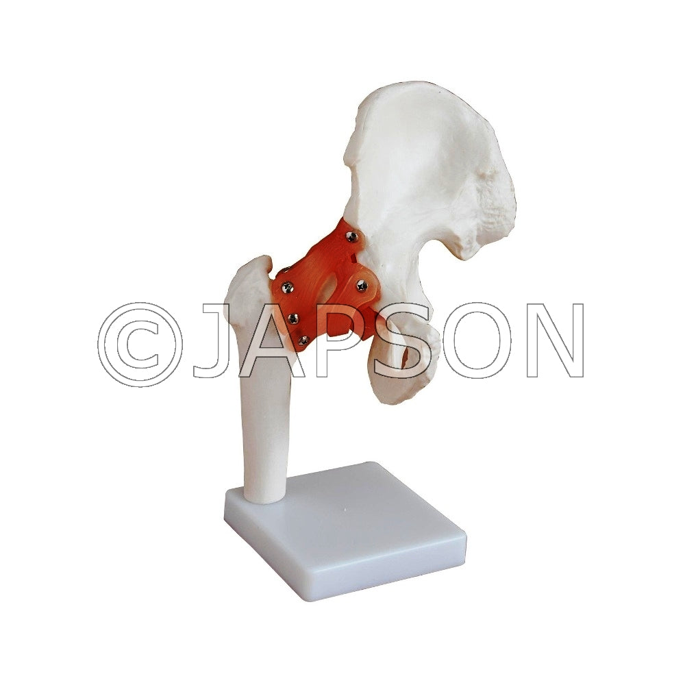 Hip Joint Model with Ligaments Model