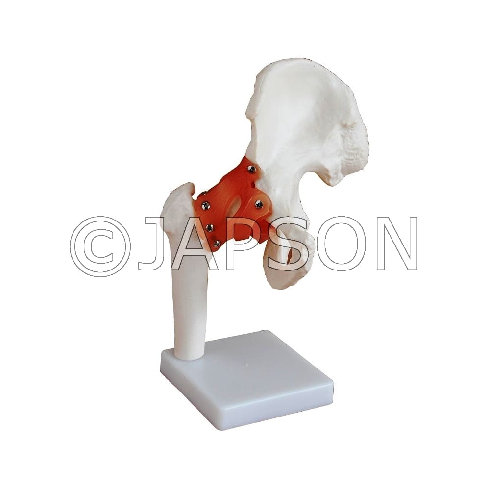 Hip Joint Model with Ligaments Model