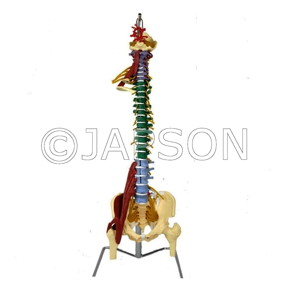 Life Size Spine with Muscles and Disorders Model