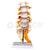 Lumbar Sacrum with Herniated Disc Model