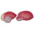 Expansion Model Of Urinary Bladder Model