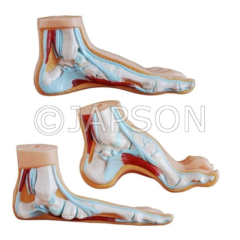 Foot Anatomy Model 3 Parts (Normal, Flat and Arched Foot) Model