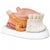 Enlarged Tongue with Teeth Model