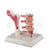Osteoporosis (Femur & 4 Vertebrae) Model