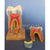 Human Teeth Model, Triple Root Molar